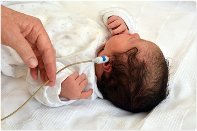 Newborn Infant during hearing screening. Significant hearing loss is the most common disorder at birth. Approximately 1%-2% of newborns are affected. Image Credit: ChameleonsEye / Shutterstock